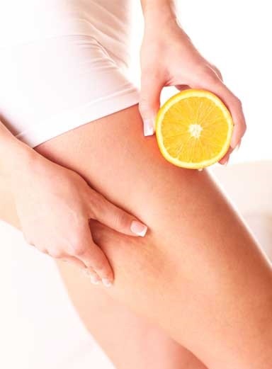 Cellulite Lipolysis - Carboxytherapy